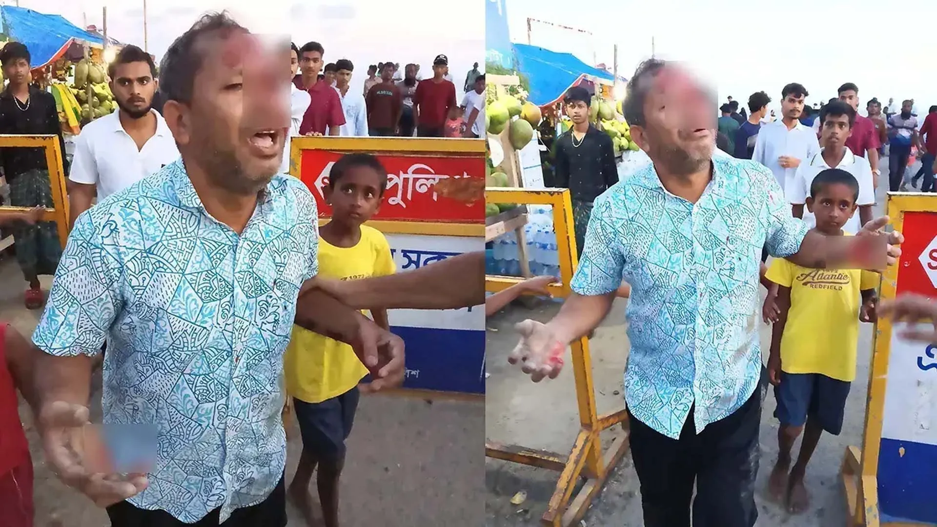 পটুয়াখালীতে মাছের ঘের নিয়ে বিরোধ, প্রকাশ্যে আইনজীবীকে পিটিয়ে জখম